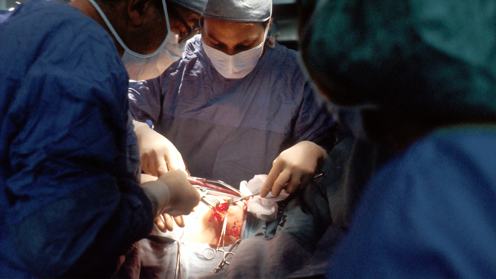 Can You Wear A Tampon During Surgery
